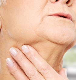 Senior woman with sagging jowl area 