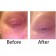 Sandy's Dr. Dennis Gross Results